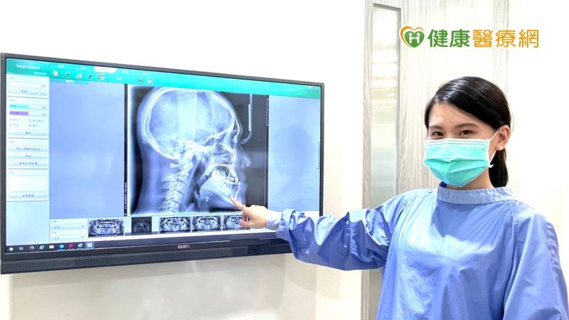 好想搬離「戽斗星球」！矯正搭配正顎手術　成功扭轉少女人生