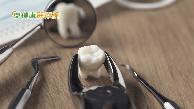 (國泰)拔牙後齒槽窩骨質會快速流失！　了解「齒槽骨保存術」避免影響牙齒重建
