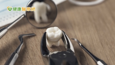 拔牙後齒槽窩骨質會快速流失！　了解「齒槽骨保存術」避免影響牙齒重建