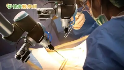 華人首位「Hugo機械手臂手術」成功！　中年男攝護腺癌恢復佳
