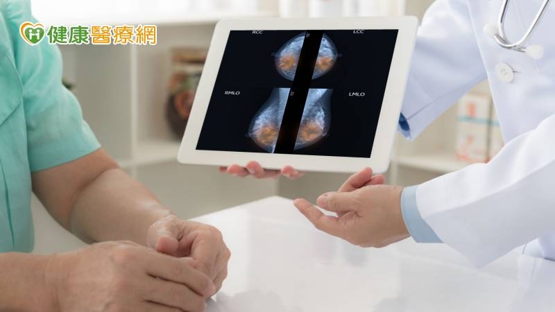 BRCA提前把關罹癌風險　精準醫療乳癌新利器