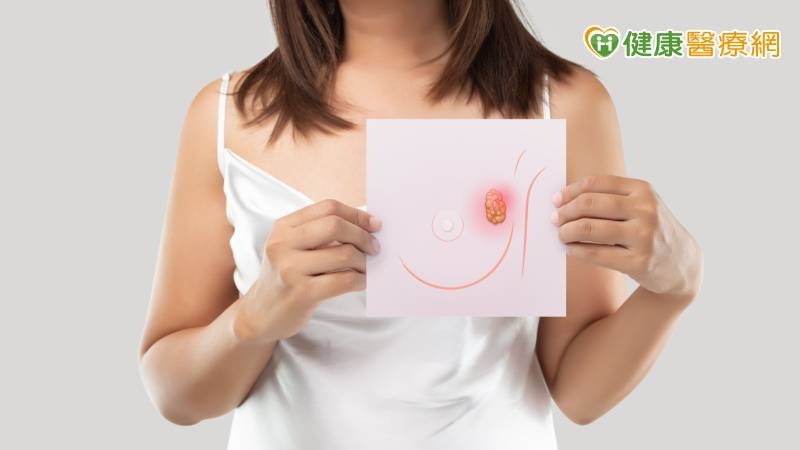 乳房出血還散發惡臭，一檢竟末期「三陰性乳癌」  免疫治療延緩惡化