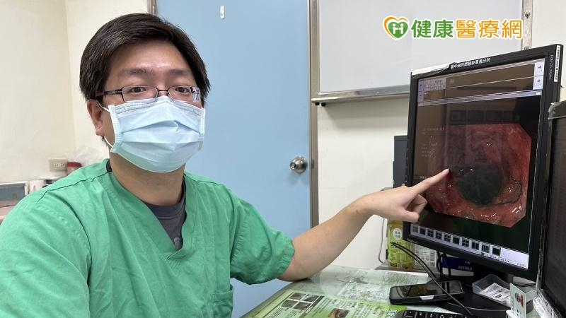 反覆腹瀉加上血便小心是「潰瘍性結腸炎」！　醫1招揪病灶