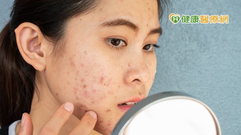 吃藥擔心副作用？療痘「心」選擇，擁有健康肌膚不是夢！