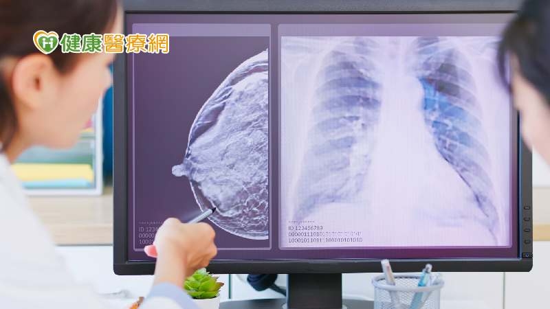（國泰）確診乳癌後該怎麼辦？　透過實際案例了解乳癌診斷、治療、追蹤過程！