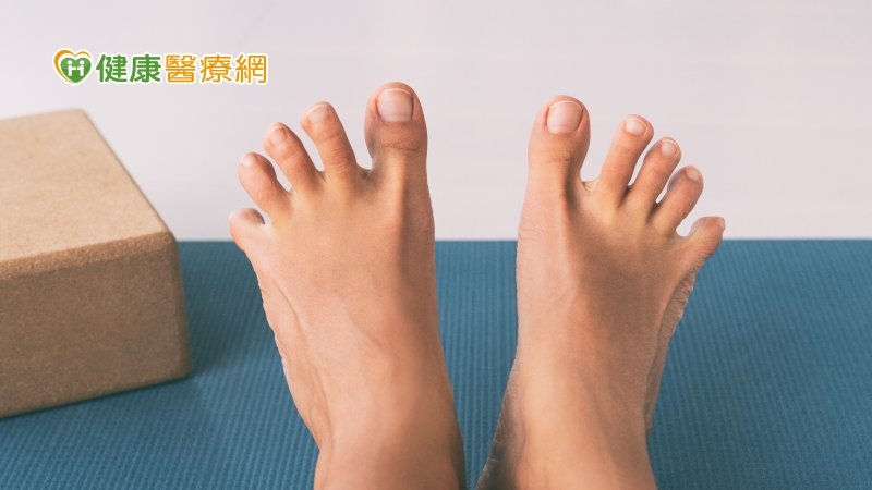 不只外觀!「大拇趾外翻」姿勢、步態、關節都受影響 拖延治療恐需手術