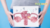 異常劇烈下腹痛，小心畸卵巢胎瘤引起！