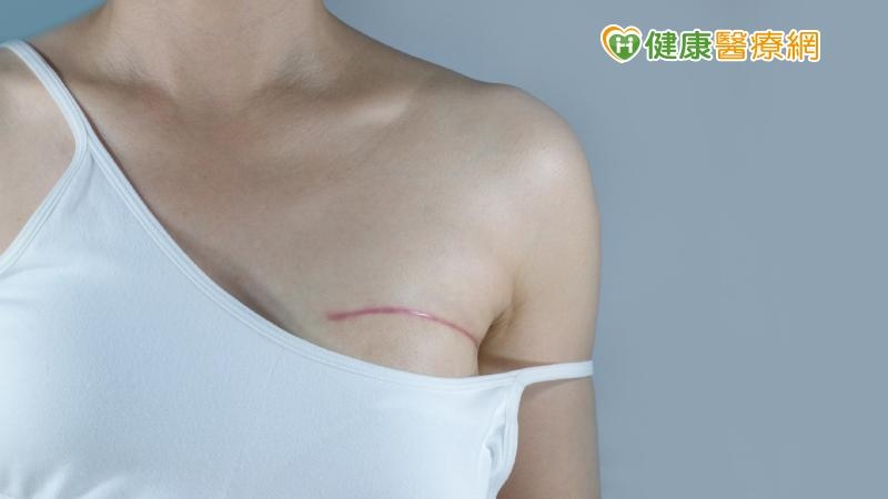 沒有乳房重建，乳癌治療只做了一半