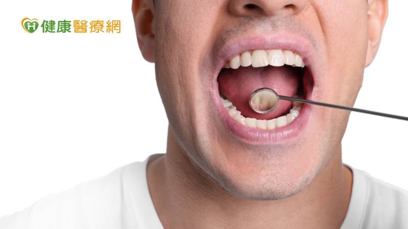 口腔癌有九成「吃這1物」　研究：致癌風險高達28倍！