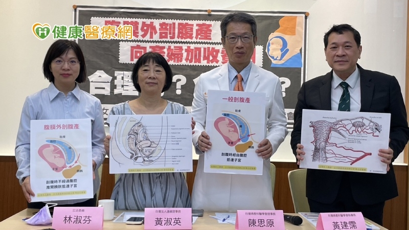 自費「腹膜外剖腹產」遭踢爆違法　衛福部：依法查辦