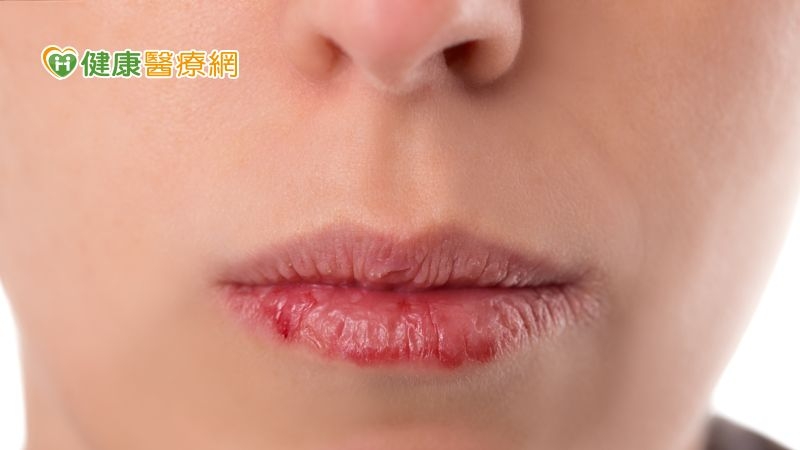 嘴唇蒼白、鮮紅、發紫居然都不健康？　唇色意義大解密