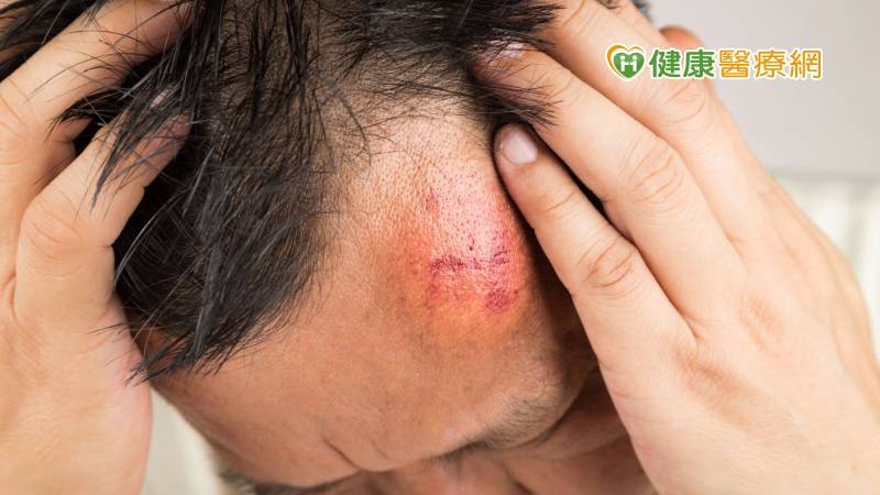 50歲男頭部莫名腫脹滲出膿血　竟是「惡性骨肉瘤」！醫：2年齡易發生