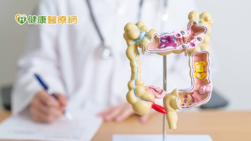 近9成大腸癌發生於「這年齡」！　篩檢陽性未做大腸鏡檢風險最高增64%