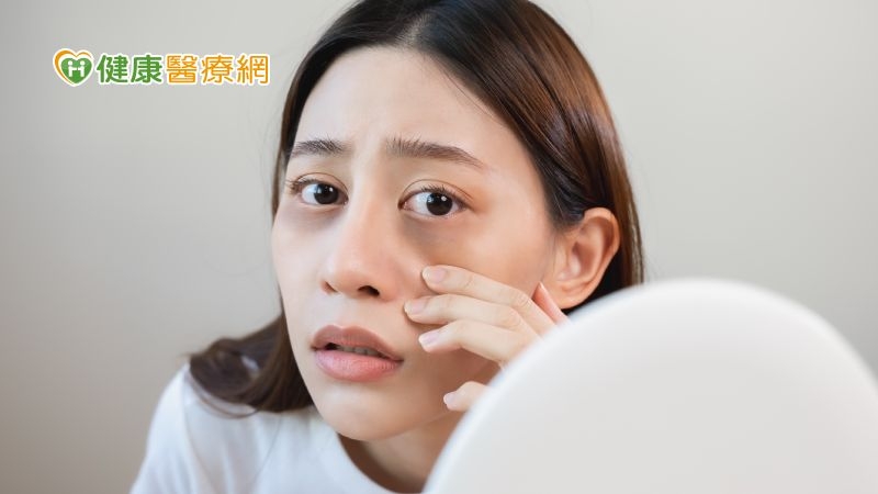 過年常有「這些」皮膚問題　醫師授保養小撇步！熬夜熬出黑眼圈也有解方