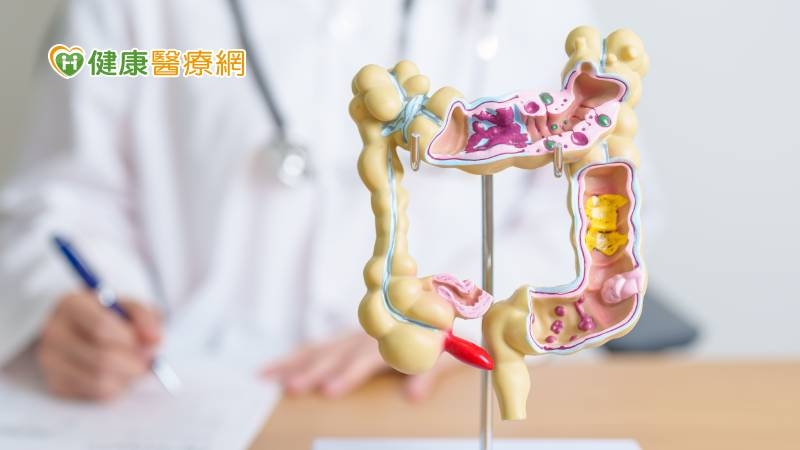 認識大腸癌分期、治療！0期仍不可<span style='color:red'>大意</span>　醫師建議諮詢第二意見更有保障