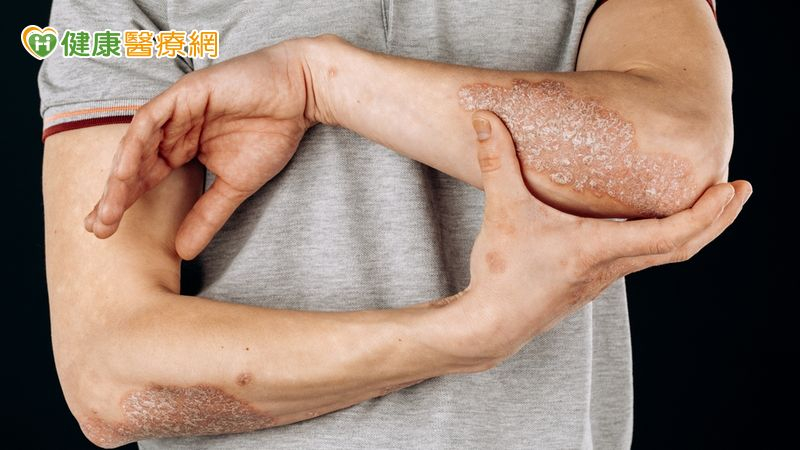 為何有些人的免疫功能比較弱？　專家「特殊自體免疫機制」惹禍　