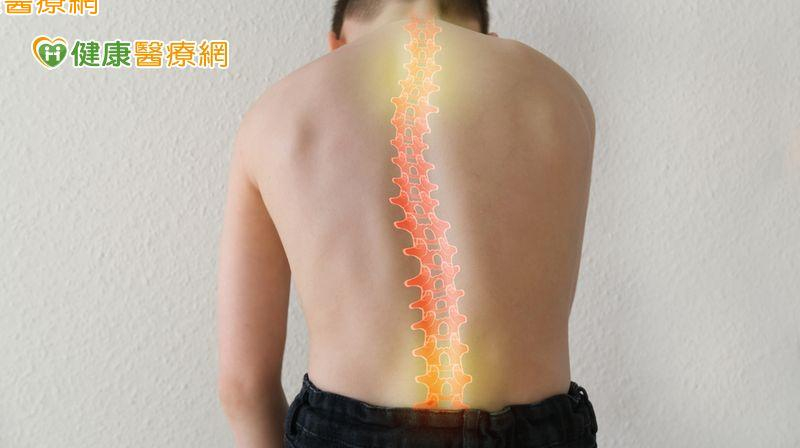 脊椎<span style='color:red'>側彎</span>中醫怎麼治療？　針灸、用藥、復健三管齊下