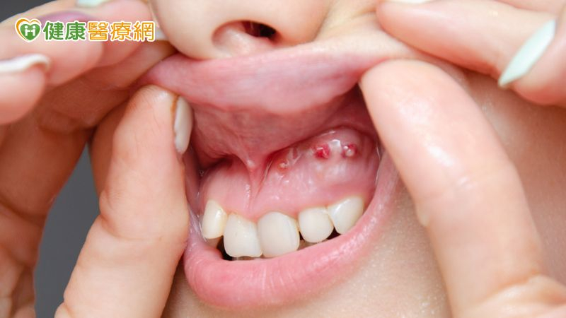 他牙齦增生「吃東西都無法咀嚼」　高醫口腔顎面外科助重拾「吃」的好滋味