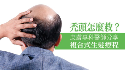 禿頭怎麼救？   皮膚專科醫師分享複合式生髮療程