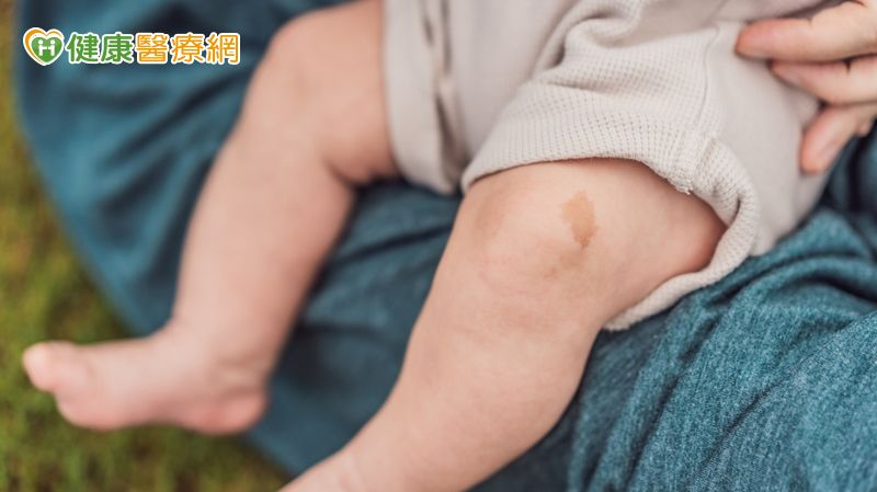 出生異常複雜「血管瘤」 11歲女童恢復行動、融入同儕