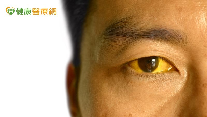 三餐規律、清淡飲食、並養成運動習慣，才能避免年紀輕輕，就養出膽結石的狀況。