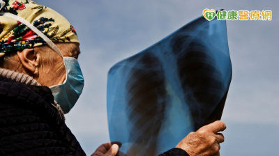 63歲男「１原因」接受肺癌早期偵測計畫　意外揪出第一期肺腺癌