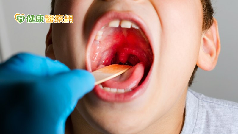 上週腸病毒門急診就診人次雖然仍以0－4歲幼兒為主（占46%），但近期5－9歲（占38%）、10－14歲（占10%）的占比有快速增加的趨勢。