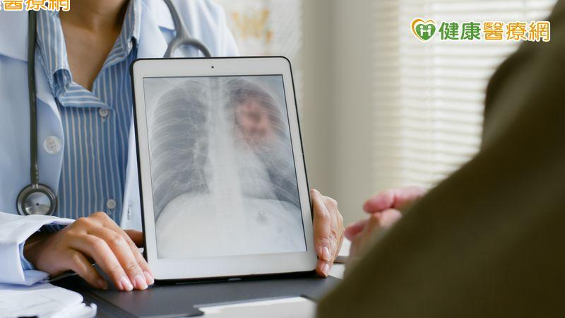 晚期肺腺癌無標靶可用有解！　免疫治療合併抗血管新生拉長存活