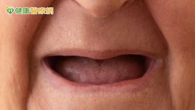 八旬嬤滿口無牙卻牙痛到流淚　原來是三叉神經痛作怪