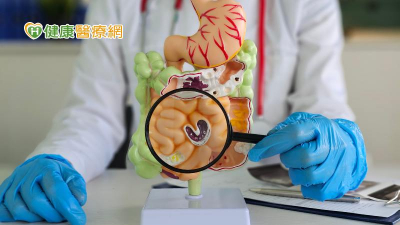 3原因可能使腸道壞菌增生　醫師教你自我檢測腸道健康！