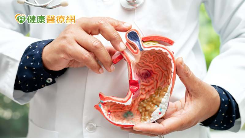 幽門螺旋桿菌是胃癌的重要風險因子之一，114年幽門桿菌篩檢試辦擴大，共17縣市參與。