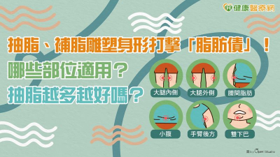 抽脂、補脂雕塑身形打擊「脂肪債」！　哪些部位適用？抽脂越多越好嗎？