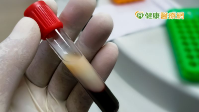 高血脂盛行率已達3成！　血脂要看哪些檢測指標？怎麼做才能有效控脂？