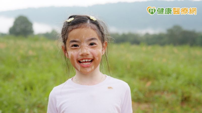 女童患白斑症飽受異樣眼光　「黑色素移植手術」助重獲自信
