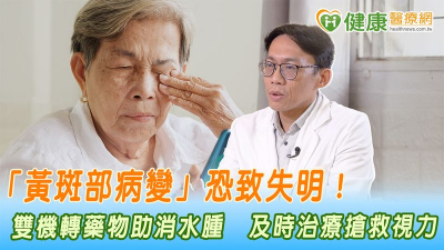 「黃斑部病變」恐致失明！雙機轉藥物助消水腫　及時治療搶救視力