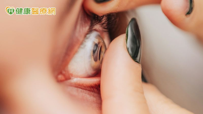 長時間配戴隱形眼鏡恐致角膜潰瘍　醫教3招防範