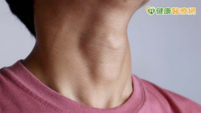 女生也會有喉結？擔心是健康出問題？醫列伴隨「4症狀」要就醫檢查！