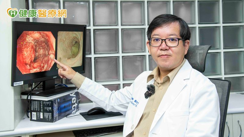 腸鏡顯示陳女士腸道病灶範圍廣、潰瘍嚴重，確診為急性嚴重潰瘍性結腸炎。