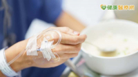 患病無法正常進食？食藥署：「特定疾病配方食品」分４類　一般民眾不宜用
