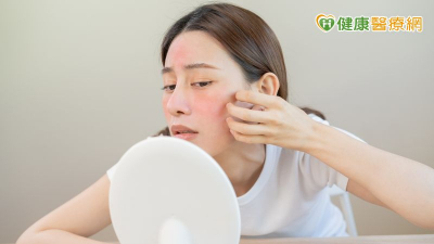業務員為工作精緻妝容反致玫瑰斑上臉！　醫曝：這些習慣最易誘發