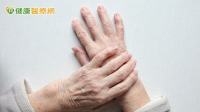 穩定免疫相關皮膚病情　風濕科醫師「這樣幫助病友」重拾正常生活
