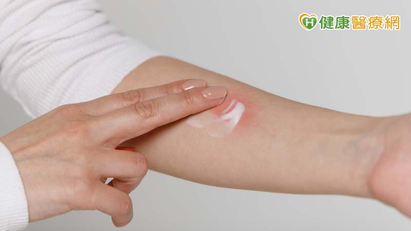 換季皮膚癢　外用藥擦越多越好？醫破解「3迷思」籲正確用藥