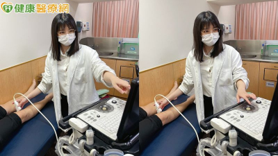 治療靜脈曲張新選擇　靜脈膠水療法恢復快免住院