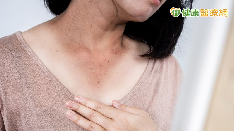 不只日曬　食藥署揭「黑色素」生成原因！可以用食材敷臉變白嗎？