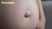 嬰幼兒、成人都可能臍疝氣！　醫教你怎麼觀察、何時該動手術
