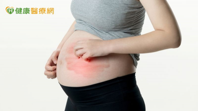 紅斑性狼瘡也能生！　醫揭關鍵藥物、照護重點