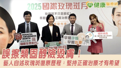 誤擦類固醇險毀膚！藝人自述玫瑰斑復原歷程：堅持正確治療才有希望