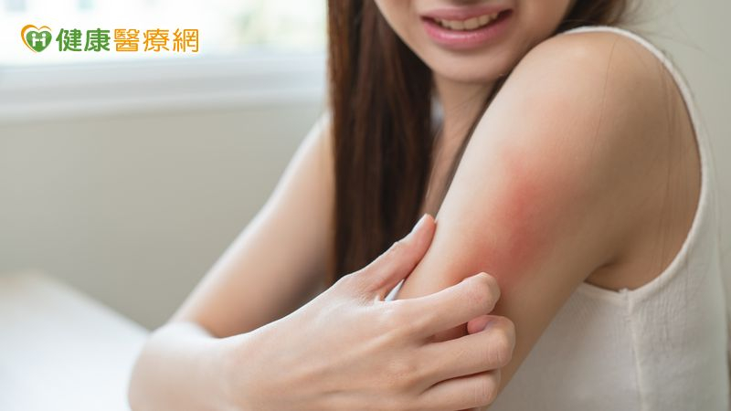 堅信自己遭蟲子纏身？皮膚醫解析何謂「妄想寄生蟲病」　家屬陪伴是治療關鍵