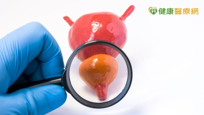 老翁攝護腺肥大轉惡性　精準影像融合切片技術助攻揪出癌