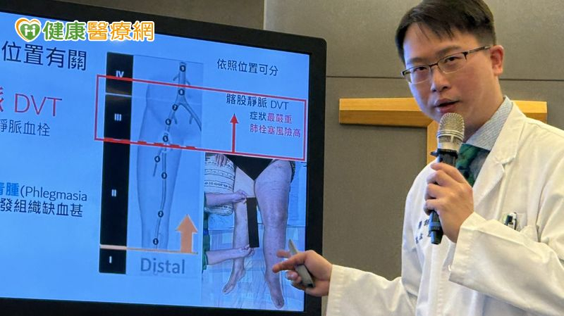 婦人左腳腫脹發紫至無法行走，經安排「經皮機械性血栓清除術」順利抽出血栓，成功保住左腿。（中華新聞雲記者鄭錦晴攝）